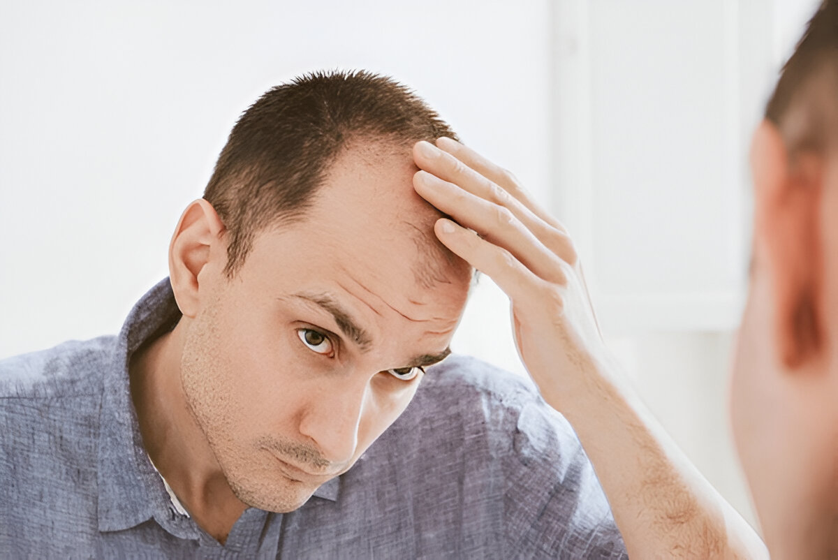 hair transplant cost London