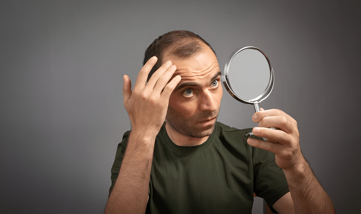 Hair Transplant Recovery Timeline Week by Week